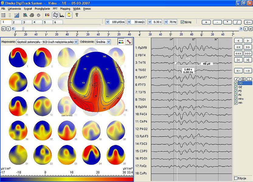 EEG mapping system EEG DigiTrack ELMIKO Medical Equipment