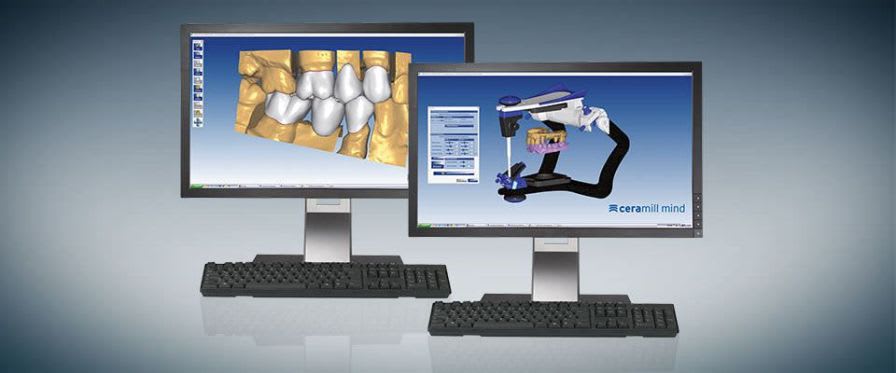 CAM software / CAD / for dental prosthesis design / medical Ceramill Mind Amann Girrbach AG
