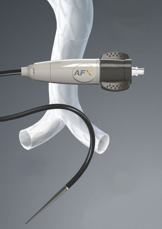 Abdominal stent graft AFX Endologix