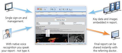 Reporting software / analysis / medical / medical imaging VUE Reporting Carestream