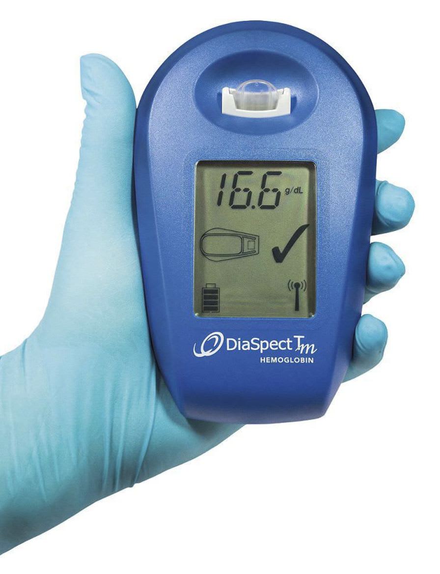 Portable hemoglobin analyzer DiaSpect Tm EKF Diagnostics