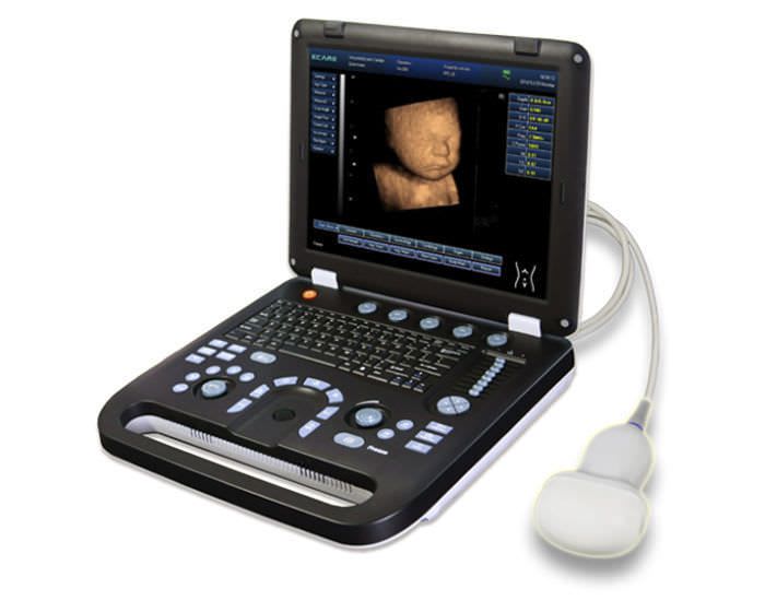 Portable ultrasound system / for gynecological and obstetric ultrasound imaging EC50A Ecare Medical Technology