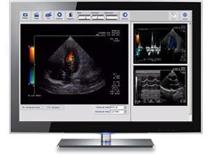 Viewing software / diagnostic / for ultrasound imaging / medical Ecofile eccosur