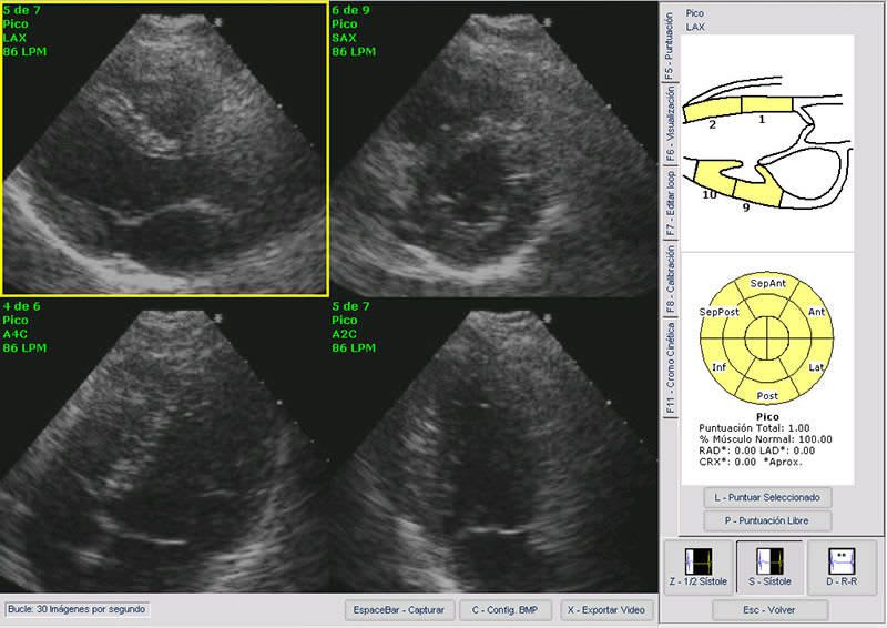 Viewing software / diagnostic / for ultrasound imaging / medical Ecoestres eccosur
