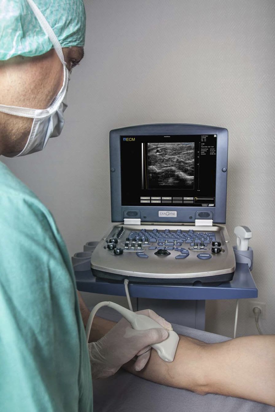 Portable ultrasound system / for multipurpose ultrasound imaging EXAGYNE ECM