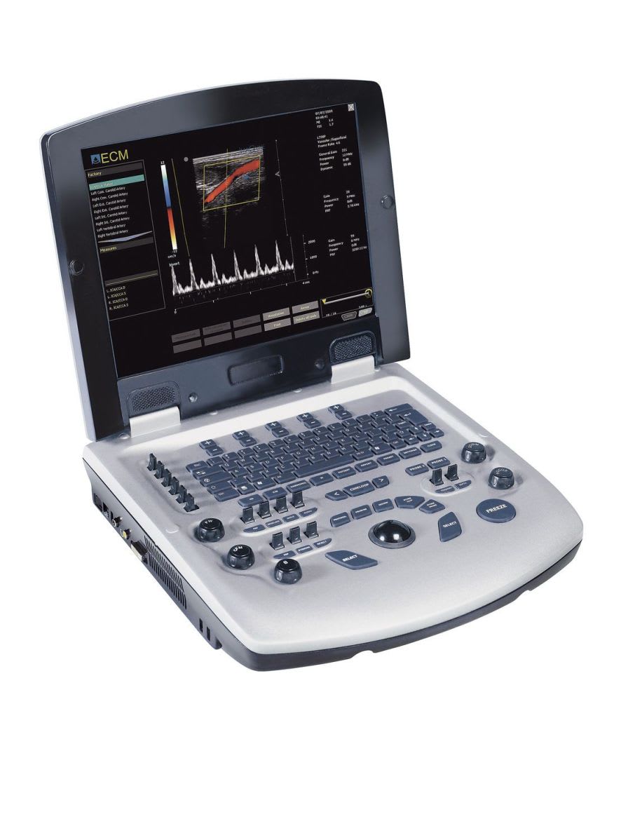 Portable veterinary ultrasound system EXAGYNE ECM