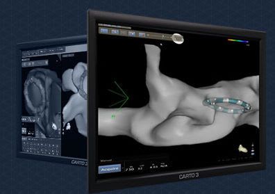 Cardiac mapping system Carto® 3 Biosense Webster