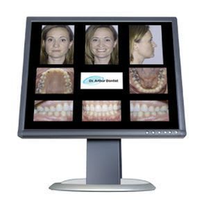 Orthodontic software / medical Carestream Dental