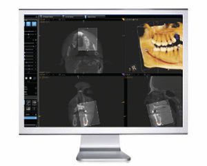 Dental imaging software / medical OMS Carestream Dental