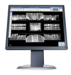 Dental imaging software / medical Carestream Dental