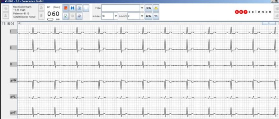 Medical software / electrocardiography VM300 Corscience