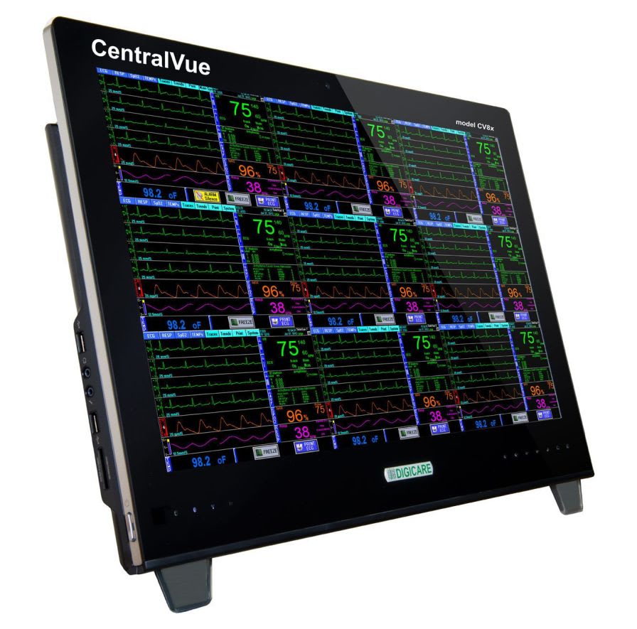 Veterinary central monitoring station 23? | CentralVue™ Digicare Animal Health