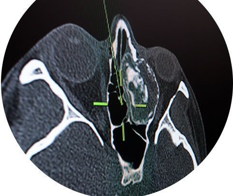 Electromagnetic surgical navigation system / optical / for ENT surgery Kick® EM Brainlab