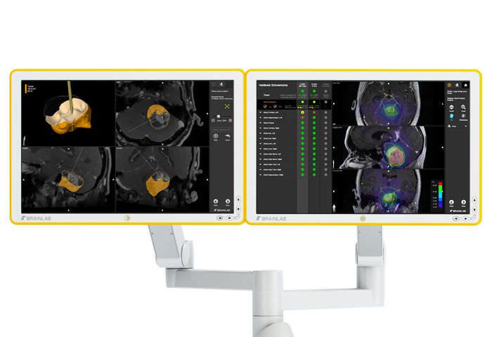Viewing software / control / planning / simulation Adaptive Hybrid Surgery Brainlab