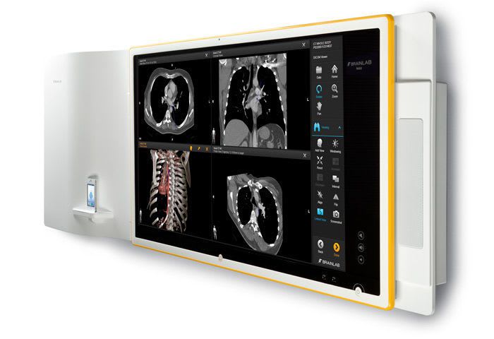 Management and communication system for / information / data / operating room Buzz™ Brainlab