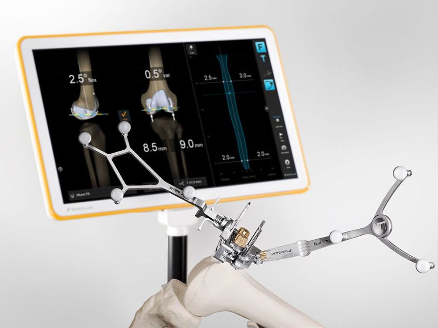 Surgical navigation software / for knee surgery / medical Brainlab