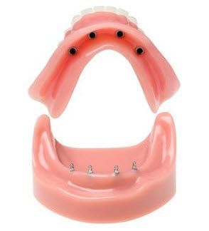 Mandible anatomical model SMDI-004 3M ESPE