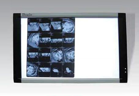 2-section X-ray film viewer LEDVIEW-740 Bowin Medical