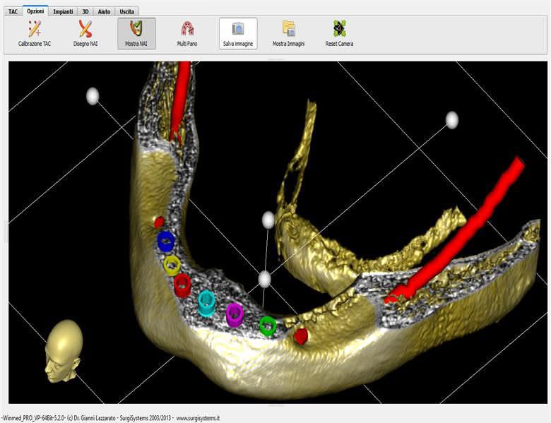 Planning software / 3D viewing / for dental imaging / surgical Winmed ARTIGLIO SNC