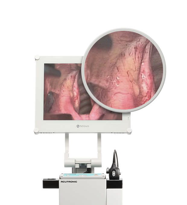 Intubation fiberscope SensaScope® ACUTRONIC Medical Systems AG