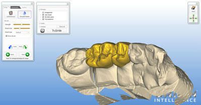 CAM software / for dental prosthesis design / CAD / medical ORIGIN HD B&D Dental Technologies