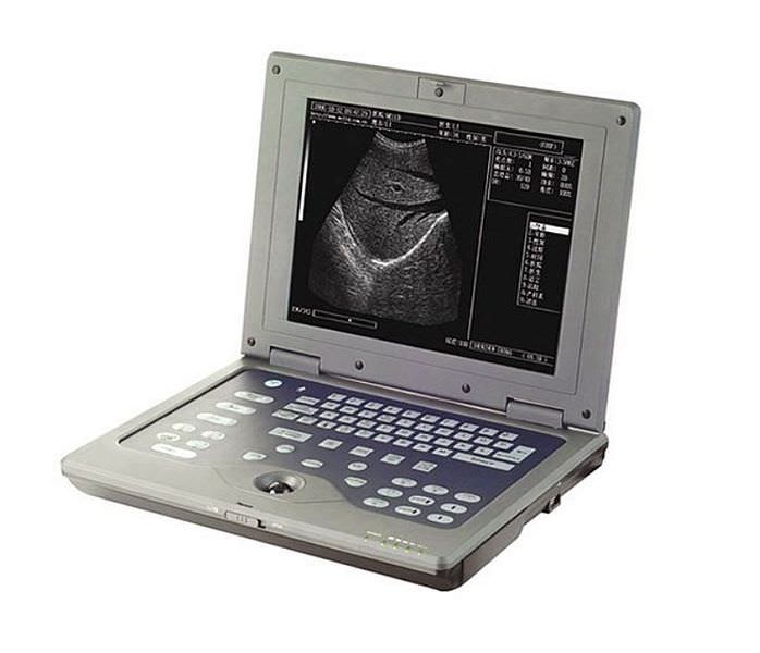 Portable ultrasound system / for multipurpose ultrasound imaging AV-3018 AMBISEA
