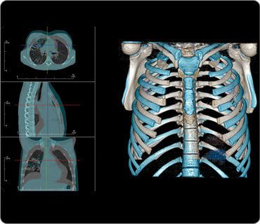 Diagnostic software / 3D viewing / medical imaging / medical Invivo5 Anatomage