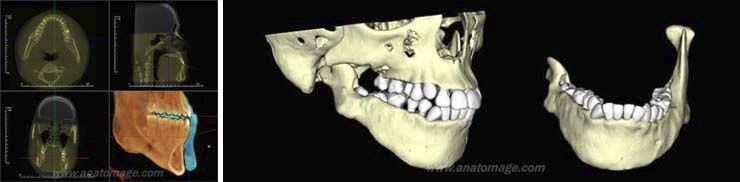 Dental surgery software / medical Anatomage