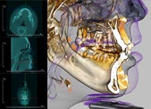 Medical software / for dental surgery Invivo5 Anatomage