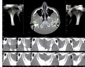 Viewing software / medical / for dental imaging TMJ Anatomage