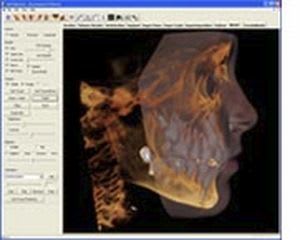 Viewing software / medical / for dental imaging Anatomodel Anatomage