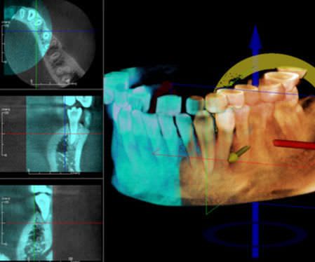 Viewing software / medical / for dental imaging Stitching Anatomage