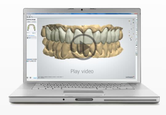 Dental prosthesis design software / CAD / dental laboratory Smile Composer™ 3shape