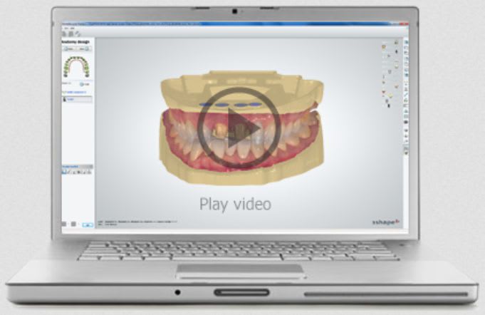 CAD software / for dental prosthesis design / dental laboratory Model Builder™ 3shape