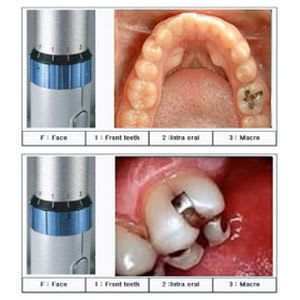 Digital camera / intra-oral / CCD / LED QuickCam Denterprise