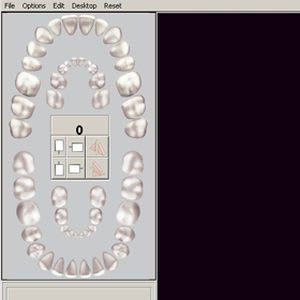Image capture software / viewing / for dental imaging Choice Imaging Denterprise