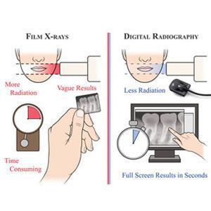 Dental radiography flat panel detector InstaRay Denterprise