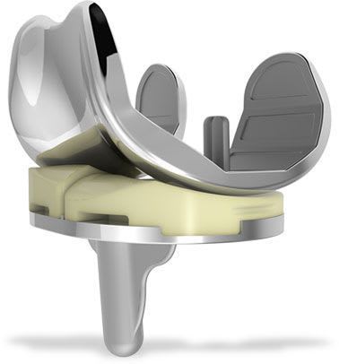 Three-compartment knee prosthesis / traditional iPoly™ XE ConforMIS
