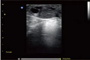 Portable veterinary ultrasound system ECO3VET chison