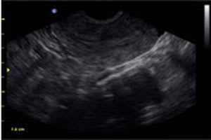 Portable ultrasound system / for multipurpose ultrasound imaging ECO1 chison