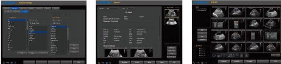 Portable veterinary ultrasound system Q5VET chison
