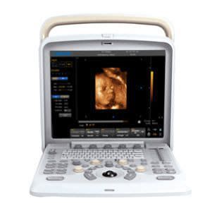 Portable ultrasound system / for multipurpose ultrasound imaging Q5 chison