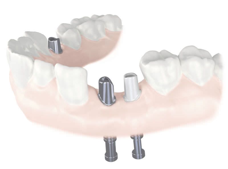 CAD software / for dental prosthesis design / medical CyrtinaCAD40 Cyrtina Dental Group