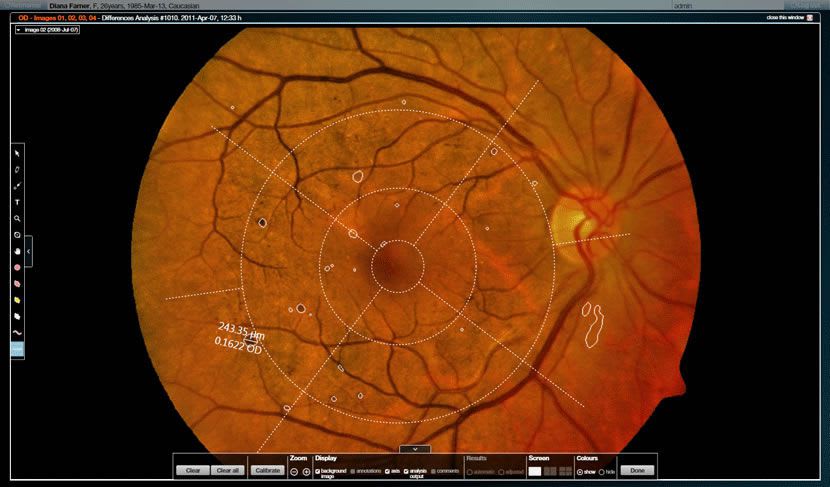 Viewing software / diagnostic / medical / ophthalmology RetmarerC critical-health