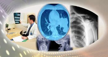 Reporting software / analysis / medical / medical imaging Radiology Regular Birlamedisoft