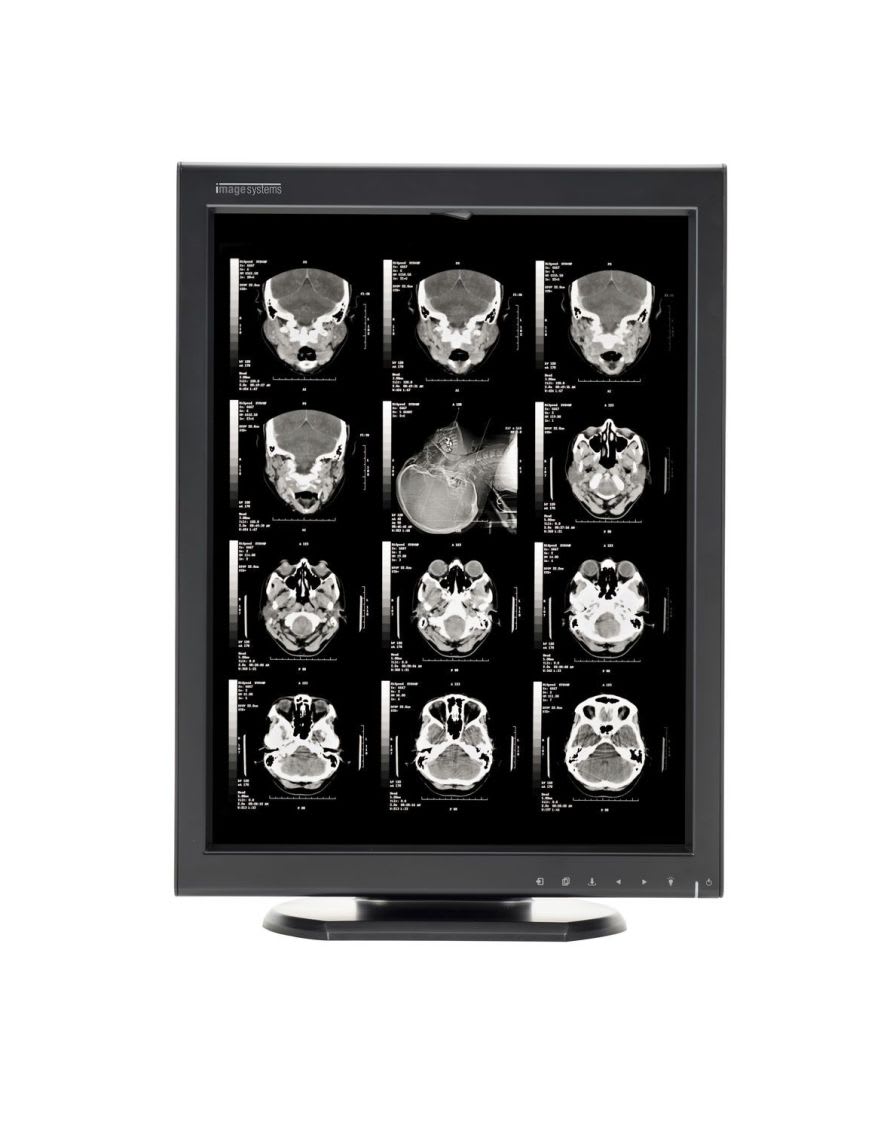 LCD display / monochrome / medical 21,2" | XLED2MPG Canvys