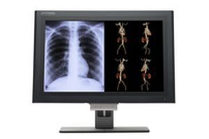 LCD display / medical 30" | XLED6MP Canvys