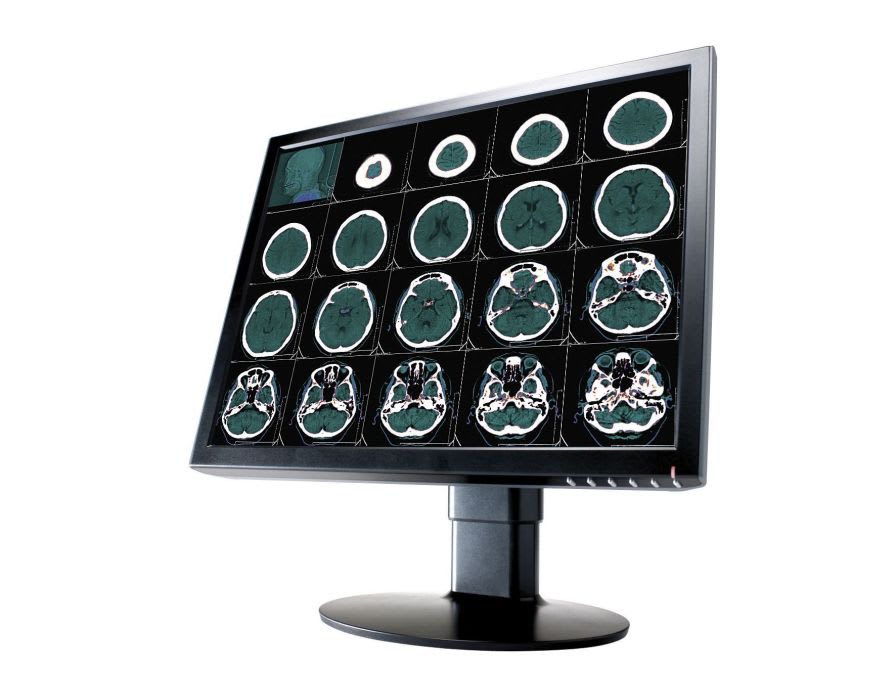 LCD display / medical 24", 2.3 MP | CL2400 Canvys