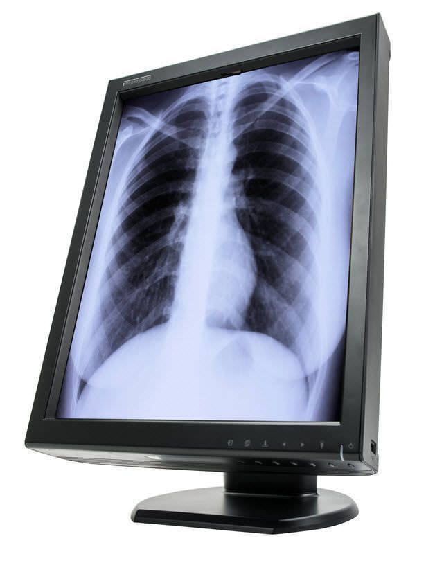 LCD display / medical 21,3" | XLED5MPG Canvys