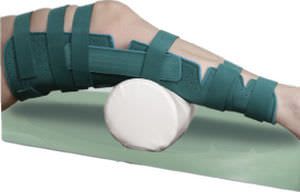 Knee splint (orthopedic immobilization) / with knee flexion pad Chrisofix
